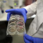 Postul regenerează celulele stem