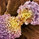 Metodă universală de detectare a cancerului