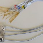 Implant transformă gândurile în vorbire