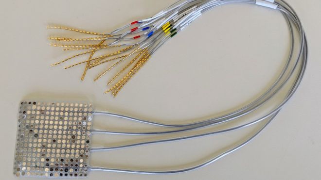 Implant transformă gândurile în vorbire