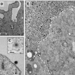 Yaravirus - virus cu gene necunoscute