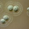 Streptomicină sp. myrophorea - soluţia în lupta cu rezistenţa la antibiotice.
